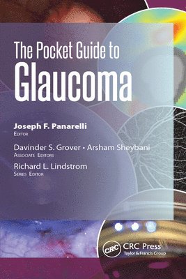 Arsham Sheybani, Davinder Grover, Joseph Panarelli - Pocket Guide to Glaucoma, E-bok