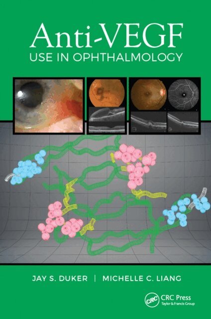 Michelle Liang, Jay Duker - Anti-VEGF Use in Ophthalmology, E-bok