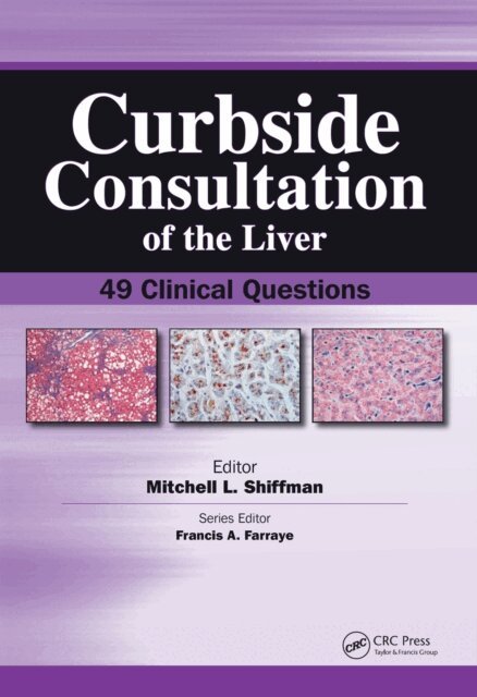 Mitchell Shiffman - Curbside Consultation of the Liver, E-bok