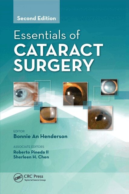 Bonnie Henderson - Essentials of Cataract Surgery, E-bok