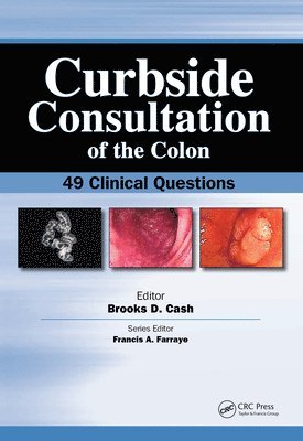 Brookes Cash - Curbside Consultation of the Colon, E-bok