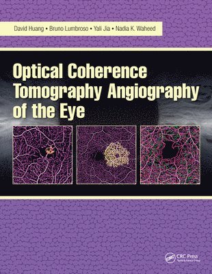 Nadia Waheed, Yali Jia, Bruno Lumbroso, David Huang - Optical Coherence Tomography Angiography of the Eye, E-bok