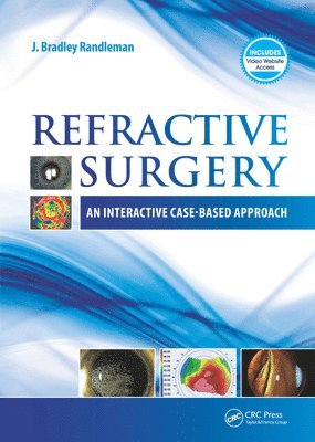 J. Bradley Randleman - Refractive Surgery, E-bok