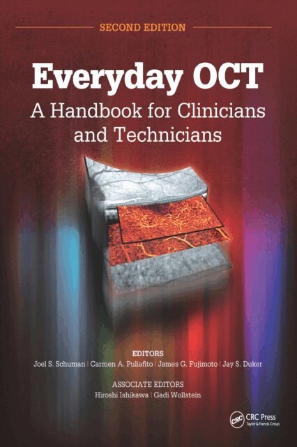 Jay Duker, James G. Fujimoto, Carmen A. Puliafito, Joel S. Schuman - Everyday OCT, E-bok