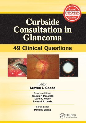 Steven Gedde - Curbside Consultation in Glaucoma, E-bok