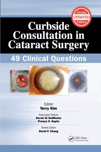 Terry Kim - Curbside Consultation in Cataract Surgery, E-bok
