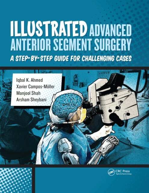 Arsham Sheybani, Manjool Shah, Xavier Moller, Iqbal Ahmed - Illustrated Advanced Anterior Segment Surgery, E-bok