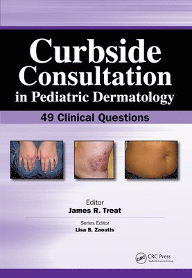James Treat - Curbside Consultation in Pediatric Dermatology, E-bok