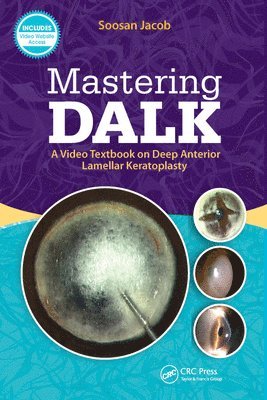 Soosan Jacob - Mastering DALK, E-bok