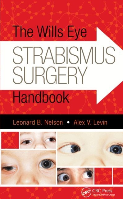 Alex Levin, Leonard Nelson - Wills Eye Strabismus Surgery Handbook, E-bok