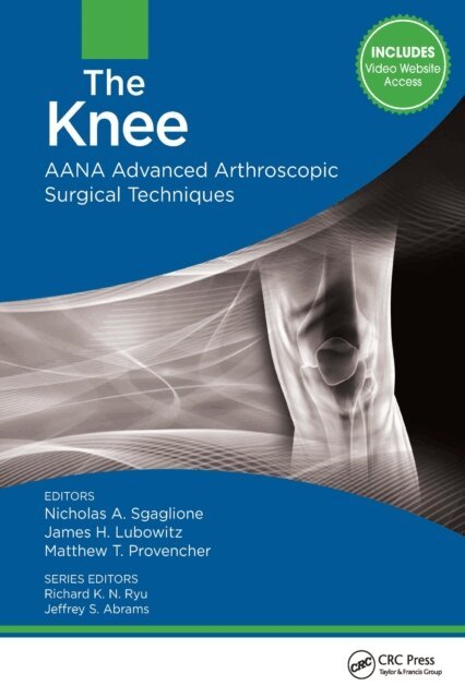 Matthew Provencher, James Lubowitz, Nicholas Sgaglione - Knee, E-bok