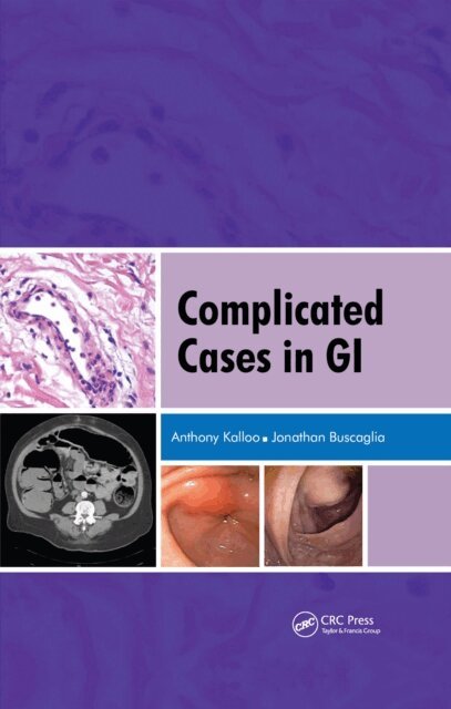 Anthony Kalloo - Complicated Cases in GI, E-bok. Tillgänglighet: Lägg i varukorg