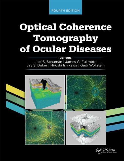 Hiroshi Ishikawa, Jay Duker, James G. Fujimoto, Joel S. Schuman - Optical Coherence Tomography of Ocular Diseases, E-bok