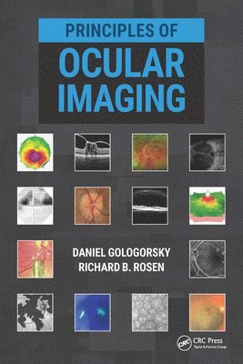 Richard Rosen, Daniel Gologorsky - Principles of Ocular Imaging, E-bok