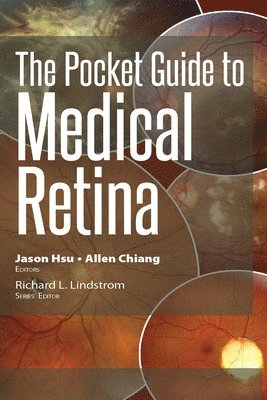 Allen Chiang, Jason Hsu - Pocket Guide to Medical Retina, E-bok