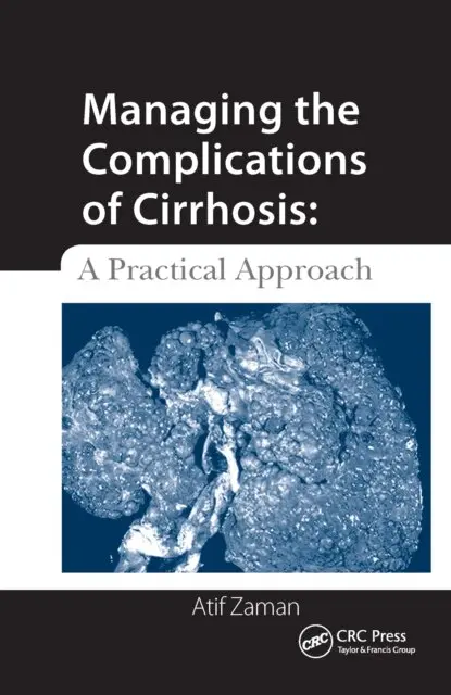 Atif Zaman - Managing the Complications of Cirrhosis, E-bok. Tillgänglighet: Lägg i varukorg