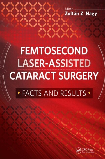 Zoltan Nagy - Femtosecond Laser-Assisted Cataract Surgery, E-bok
