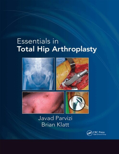 Brian Klatt, Javad Parvizi - Essentials in Total Hip Arthroplasty, E-bok. Tillgänglighet: Lägg i varukorg