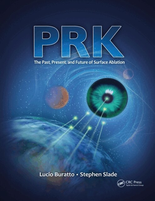 Stephen Slade, Lucio Buratto - PRK, E-bok. Tillgänglighet: Lägg i varukorg