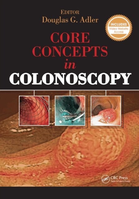 Douglas Adler - Core Concepts in Colonoscopy, E-bok
