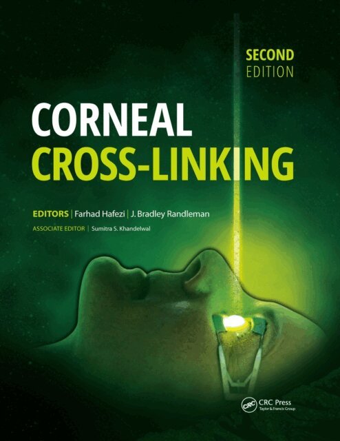 J. Bradley Randleman, Farhad Hafezi - Corneal Cross-Linking, E-bok