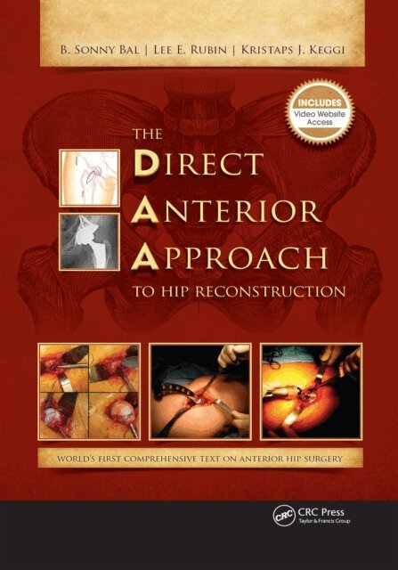 Kristaps Keggi, Lee Rubin, B. Bal - Direct Anterior Approach to Hip Reconstruction, E-bok