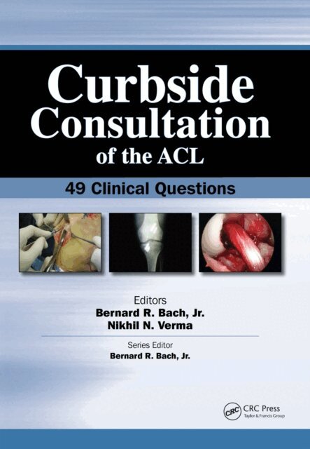 Nikhil Verma, Bernard Bach - Curbside Consultation of the ACL, E-bok