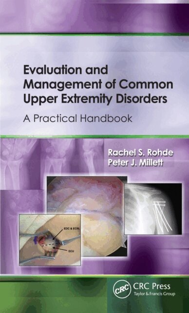 Peter Millett, Rachel Rohde - Evaluation and Management of Common Upper Extremity Disorders, E-bok