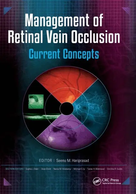 Seenu Hariprasad - Management of Retinal Vein Occlusion, E-bok. Tillgänglighet: Lägg i varukorg