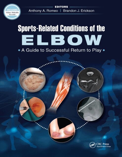 Brandon Erickson, Anthony Romeo - Sports-Related Conditions of the Elbow, E-bok