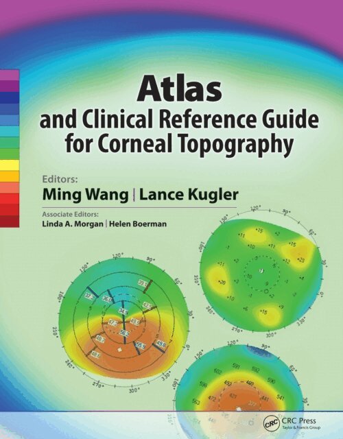 Lance Kugler, Ming Wang - Atlas and Clinical Reference Guide for Corneal Topography, E-bok