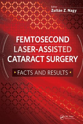 Zoltan Nagy - Femtosecond Laser-Assisted Cataract Surgery, E-bok