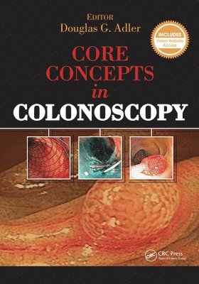 Douglas Adler - Core Concepts in Colonoscopy, E-bok