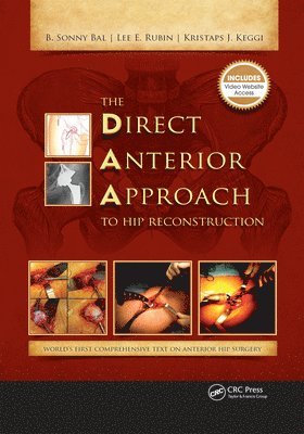 Kristaps Keggi, Lee Rubin, B. Bal - Direct Anterior Approach to Hip Reconstruction, E-bok