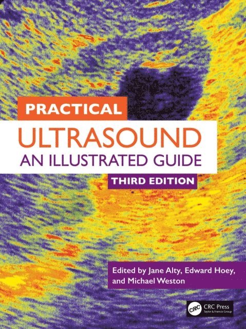 Michael Weston, Edward Hoey, Jane Alty - Practical Ultrasound, E-bok