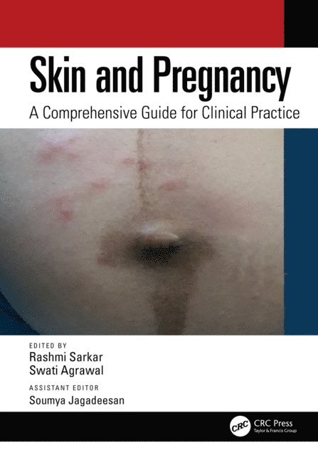 Soumya Jagadeesan, Swati Agrawal, Rashmi Sarkar - Skin and Pregnancy, E-bok
