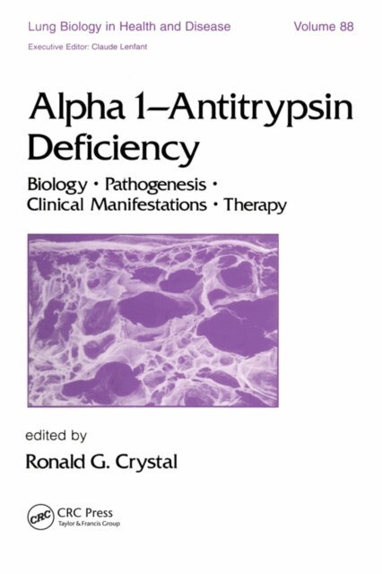 Crystal, Ronald G. Crystal - Alpha 1 - Antitrypsin Deficiency, E-bok. Tillgänglighet: Lägg i varukorg