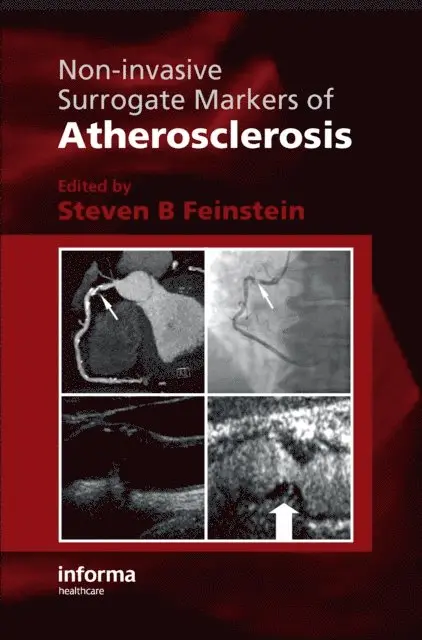 Steven B. Feinstein - Non-Invasive Surrogate Markers of Atherosclerosis, E-bok. Tillgänglighet: Lägg i varukorg