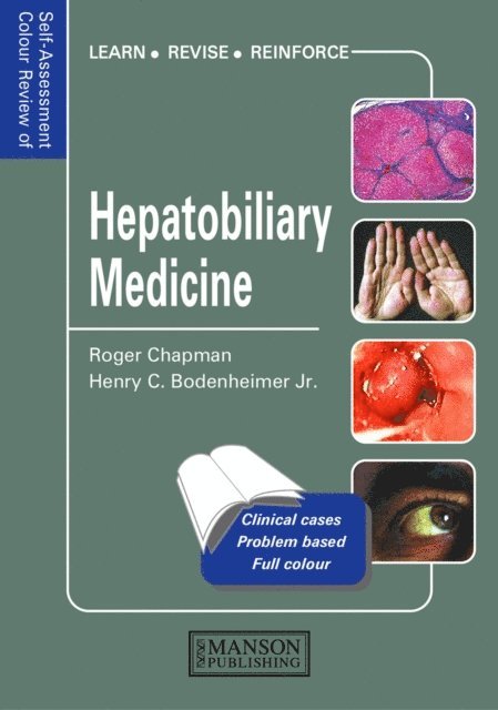 Henry Bodenheimer Jr., Roger Chapman - Hepatobiliary Medicine, E-bok