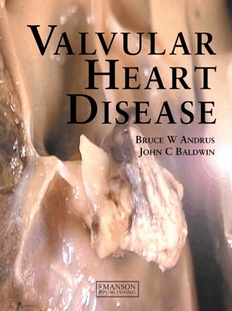 John Baldwin, Bruce Andrus - Valvular Heart Disease, E-bok