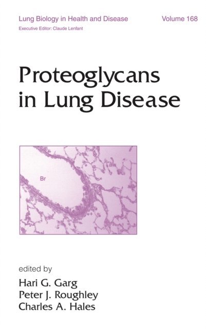 Hari G. Garg - Proteoglycans in Lung Disease, E-bok