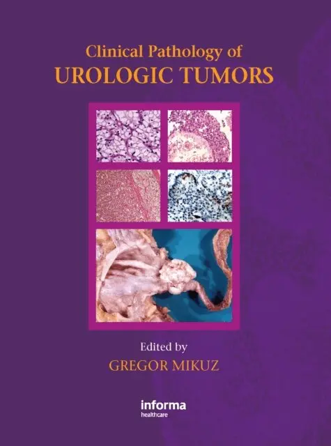 Clinical Pathology of Urological Tumours