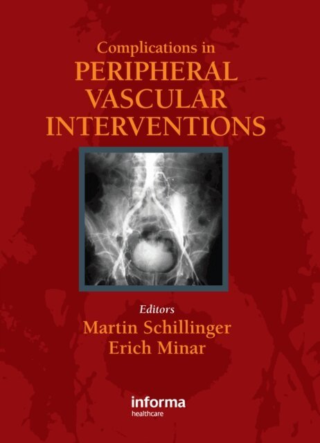 Erich Minar, Martin Schillinger - Complicatons in Peripheral Vascular Interventions, E-bok. Tillgänglighet: Lägg i varukorg