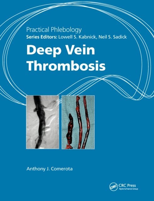 Anthony J. Comerota - Practical Phlebology, E-bok. Tillgänglighet: Lägg i varukorg