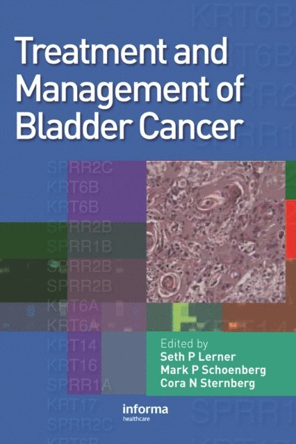 Cora N Sternberg, Mark P Schoenberg, Seth P. Lerner - Treatment and Management of Bladder Cancer, E-bok