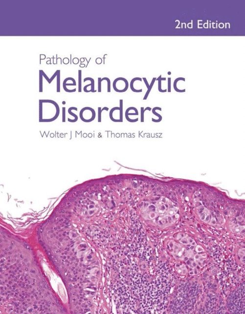Thomas Krausz, Walter Mooi - Pathology of Melanocytic Disorders 2ed, E-bok