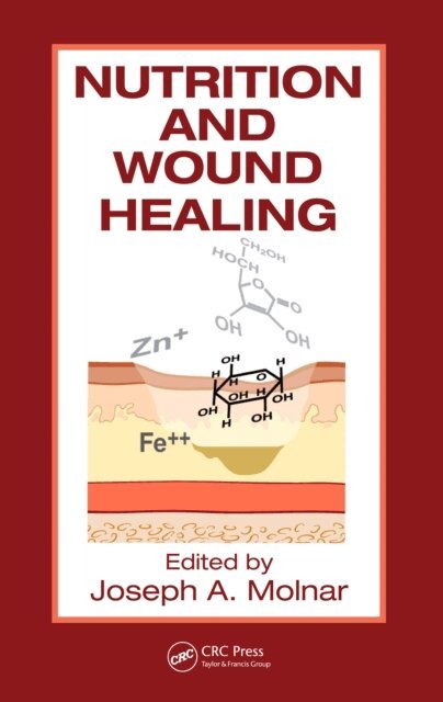 Joseph A. Molnar MD PhD FACS - Nutrition and Wound Healing, E-bok