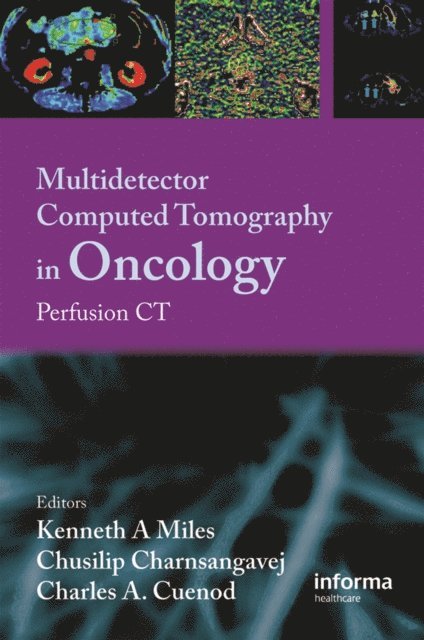 C. Cuenod, C. Charnsangavej, Kenneth Miles - Multi-Detector Computed Tomography in Oncology, E-bok