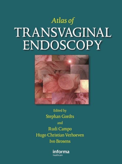 Ivo Brosens, Rudi Campo, Hugo C. Verhoeven, Stephan Gordts - Atlas of Transvaginal Endoscopy, E-bok