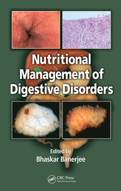 Bhaskar Banerjee - Nutritional Management of Digestive Disorders, E-bok. Tillgänglighet: Lägg i varukorg